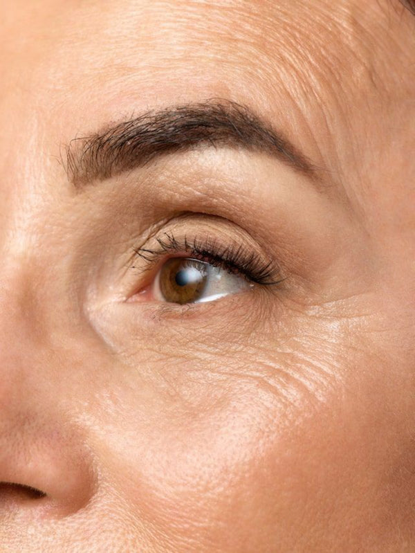Anti-Aging & Wrinkles